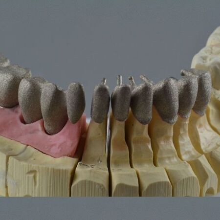 Implantate