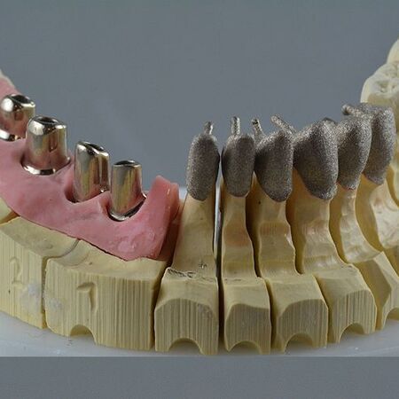 Implantate