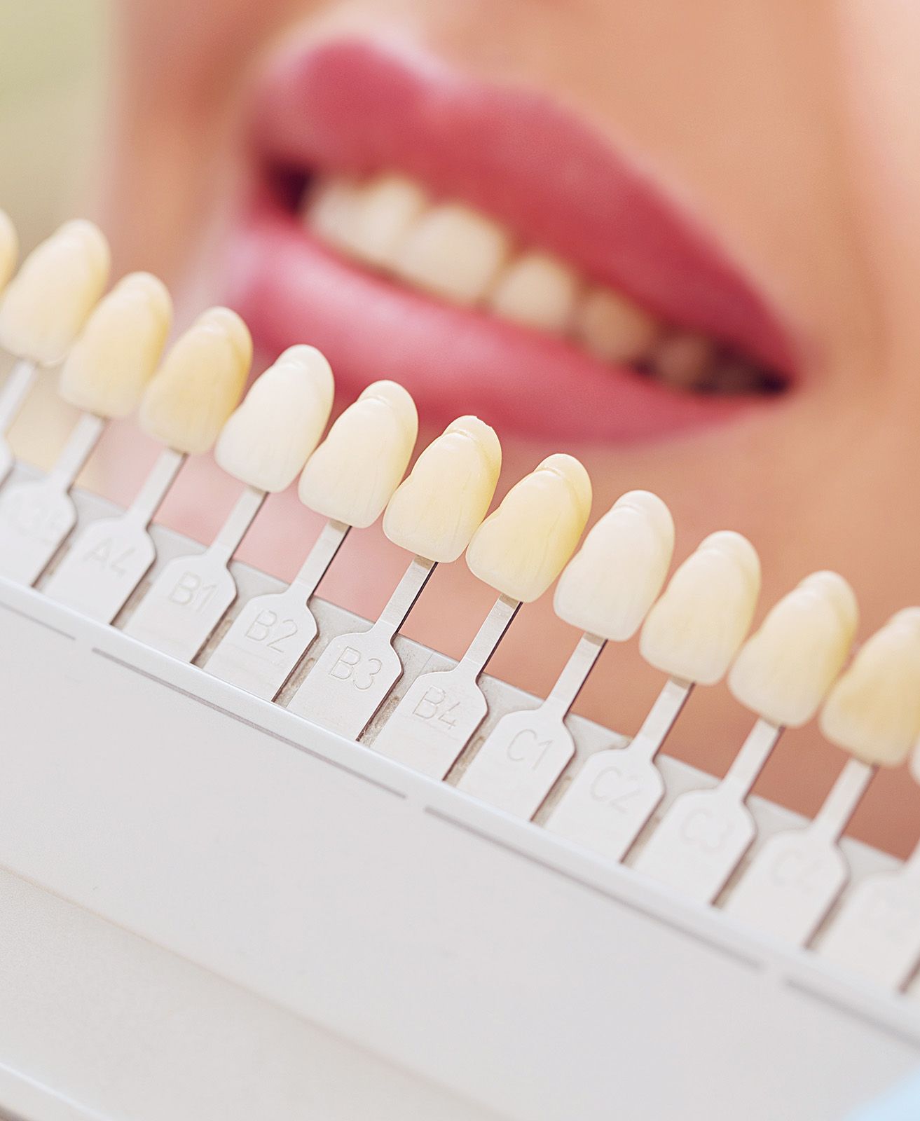 Voll- & Teilverblendung